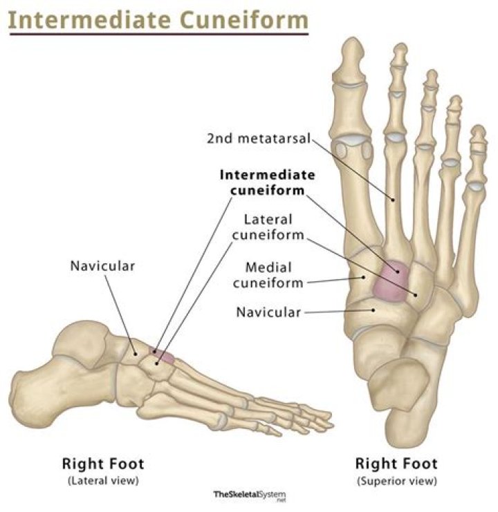 What causes cuneiform pain